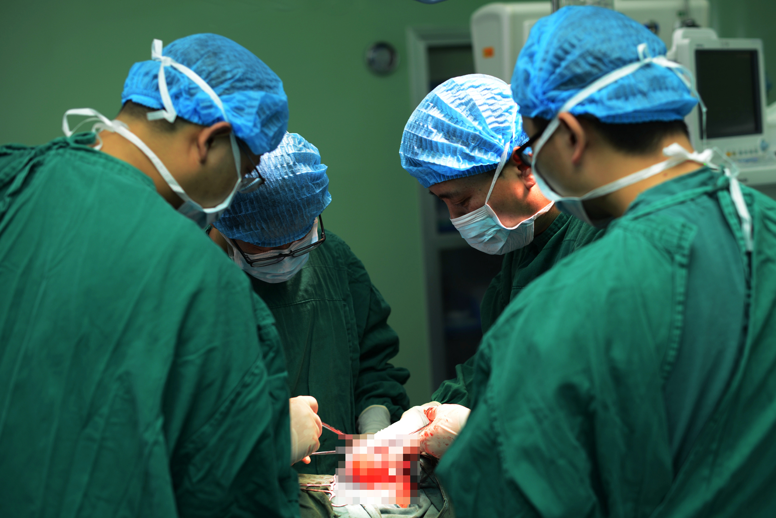 甲状腺外科团队实施高难度手术